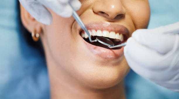Best Emergency Treatment for Oral Infections in Old Stine, CA